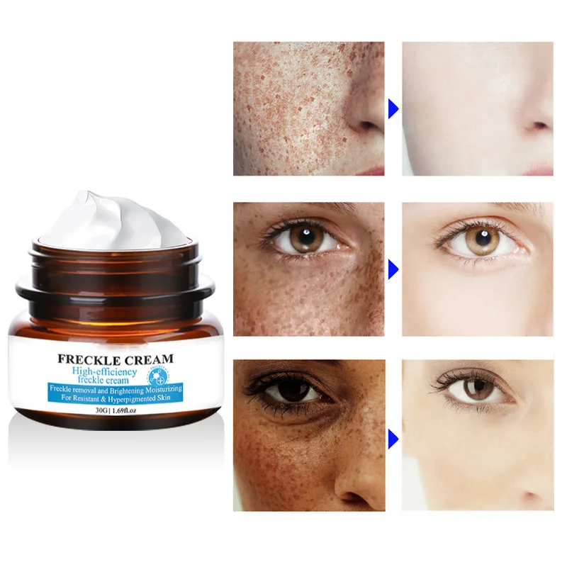 

Freckle Cream Wrinkles Removal Hydrating Moisturizing Brightens Skin Firming Anti Aging Lifting Remove Fineline Skin Care