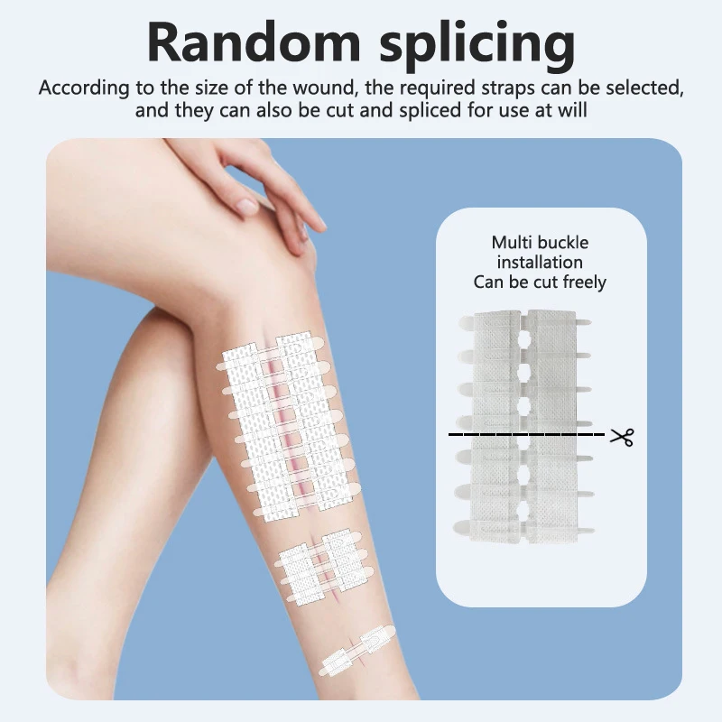 Zip Stitch Wound Bandages