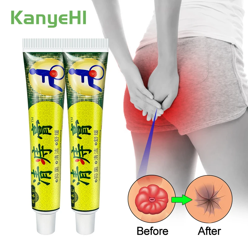 

Китайский крем от геморроя, 2 шт., снятие боли в анале, китайская травяная медицинская мазь от геморроя, крем для облегчения боли A953