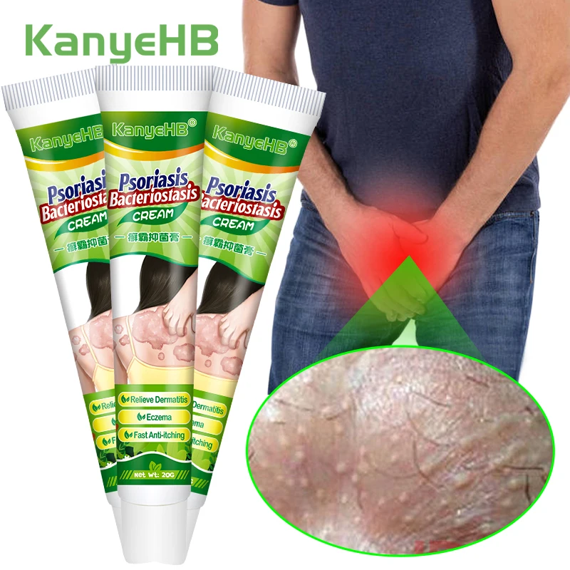 

3Pcs Psoriasis Cream Eczema Ointment Treat Desquamation Chinese Herb Medical Skin Care Ointment Antibacterial Anti-Itch A1055