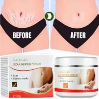 2022 new pregnancy repair cream to remove stretch marks scarring emulsion stretch marks treatment ointment