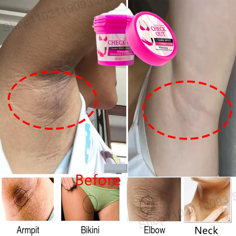 

50g Armpit Whitening Cream Improve Dullness Skin Lightening Bleaching Cream For Underarms Knees Private Parts Brighten Skin