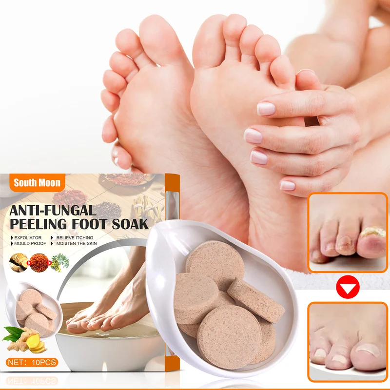 Tratamiento para el cuidado de los pies, tabletas de baño para pies, medicina china, herramienta para el cuidado de la salud, Peeling, antihongos, ingredientes naturales