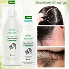 Травяной шампунь для лечения волос с женьшенем и кератином Zudaifu, 120 мл300 мл, антибактериальная Сыворотка для роста и удаления клещей и восстановления волос