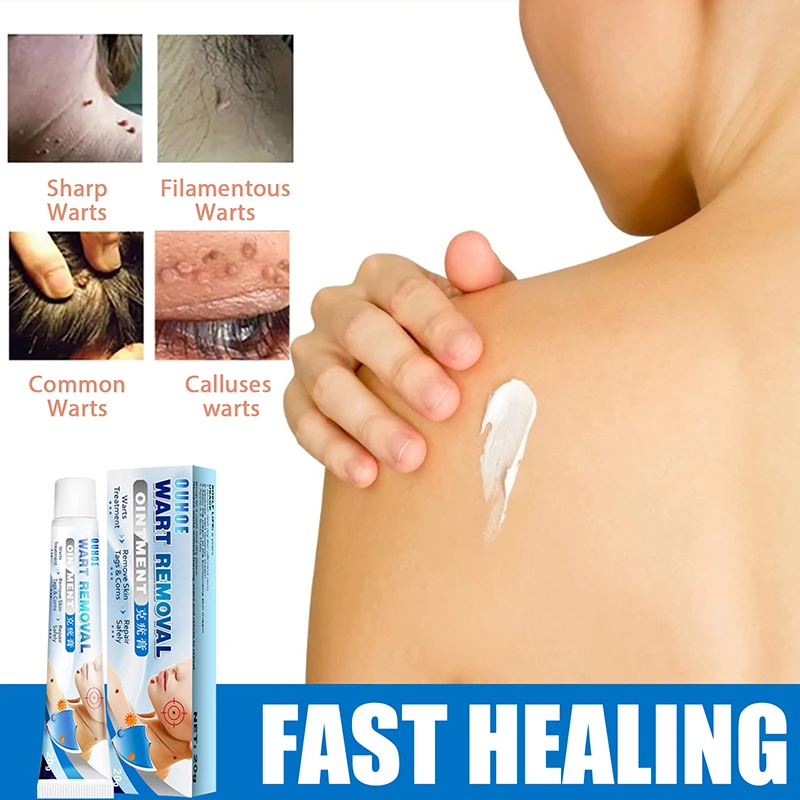 

2Pcs Warts Remover Cream Antibacterial Ointment Wart Treatment Cream Skin Tag Remover Herbal Extract Corn Plaster Warts Ointment