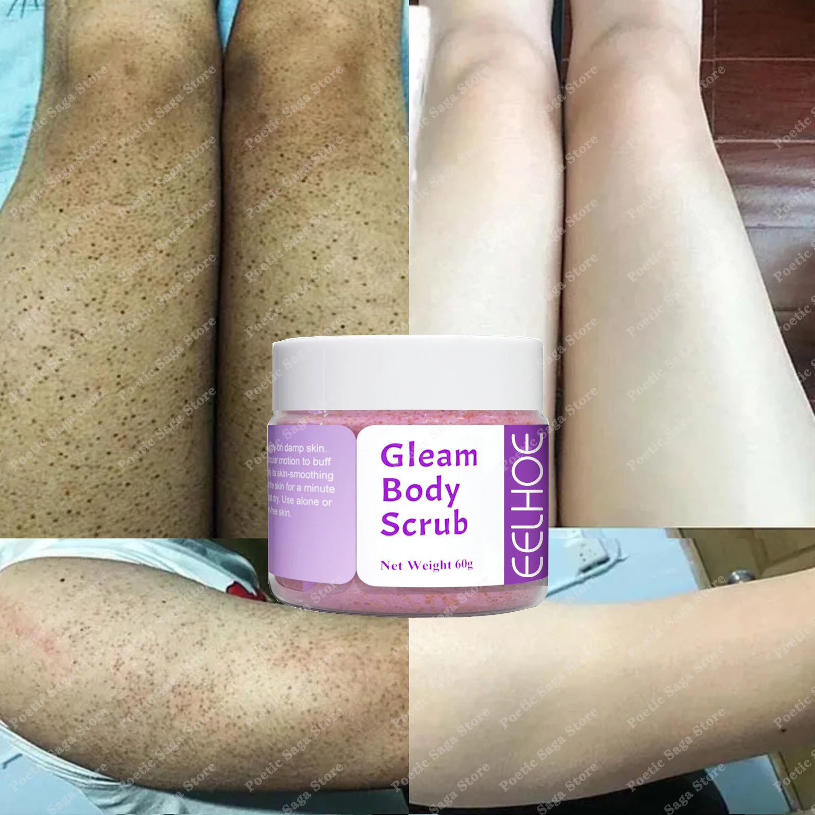 

Keratosis Pilaris Cream For Strawberry Legs Removal KP Bump Eraser Dark Spots Face Body Smooth Whitening Moisturizes Skin Care
