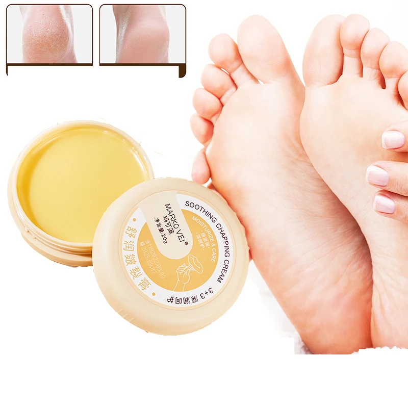 Heel Cracked Repair Cream Moisturizing Removal Dead Skin Hand Chapping Cream Feet Skin Care 20g