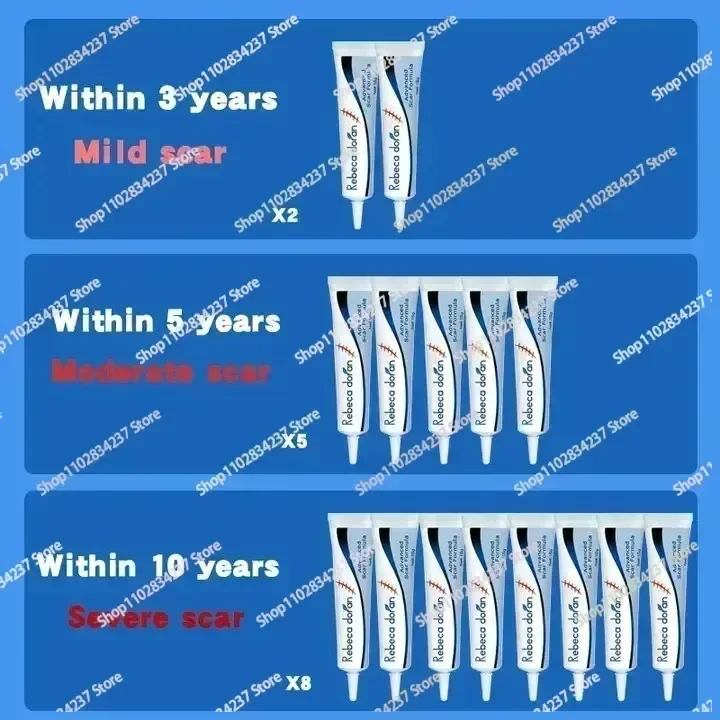 ГОРЯЧАЯ ПРОДАЖА крем для устранения линии беременности удаление старых красных