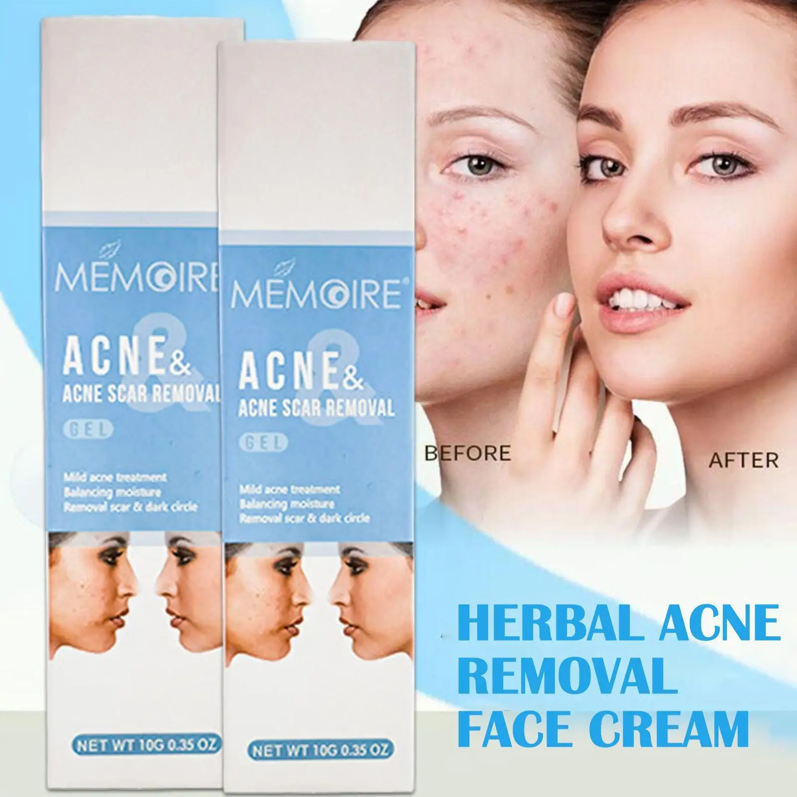 

Herbal Acne Removal Face Cream Oil Control Anti-acne Care Mark Gel Whitening Treatment Eliminate Cream Pimples Skin W0a2