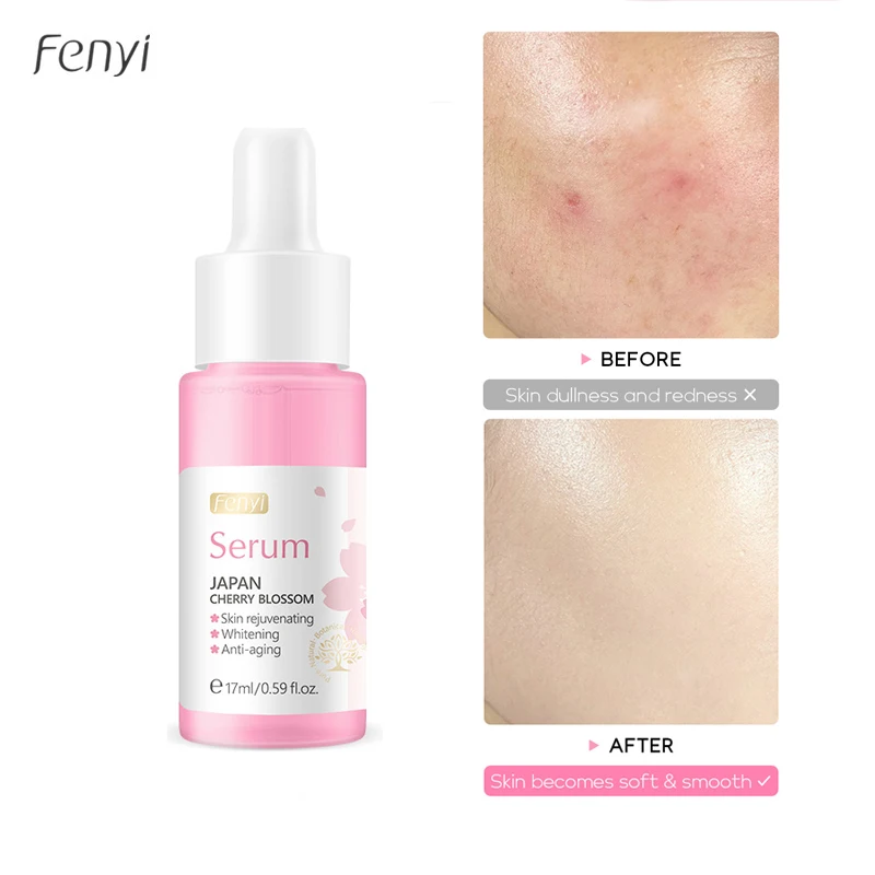 

Fenyi 17ml Japan Sakura Essence Moisturizing Whitening Face Serum Anti-Aging Anti-Wrinkle Firming Shrinking Pore Face Skin Care