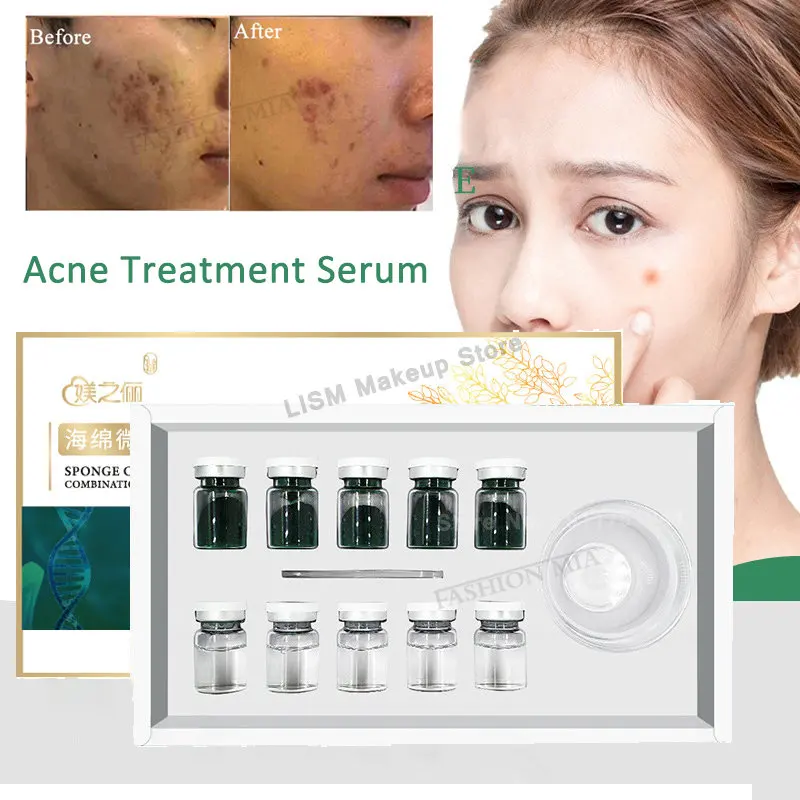

Hyaluronic Acid Serum Acne Treatment Ampoules Scar Dark Spots Removing Serum Algae Sponge Microneedle for Skin Rejuvenat Essence