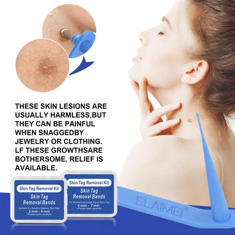 

2 IN 1 Skin Tag Removal Kit Home Use Painless Easy Mole Wart Remover Equipment Micro Skin Tag Tool Skin Care Tool
