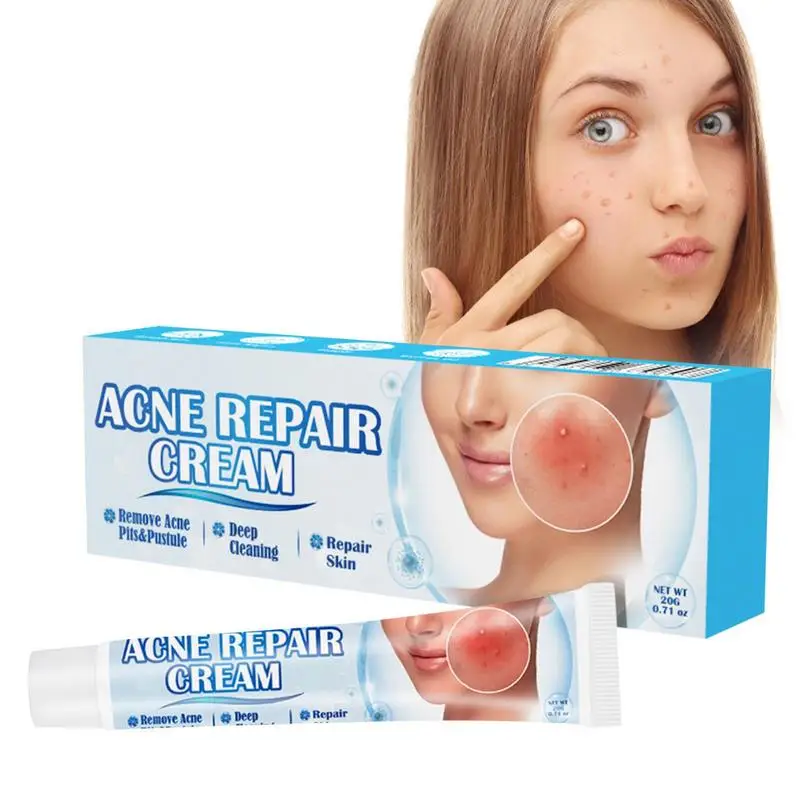 

20g Scar Healing Cream Rapid Repair of Old and New Pimple Marks Skin Redness Treatments Ointment Face Cream Heals Acnes Scarring