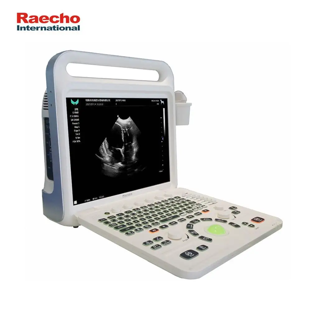 

Professional Portable Color Ultrasound Machine