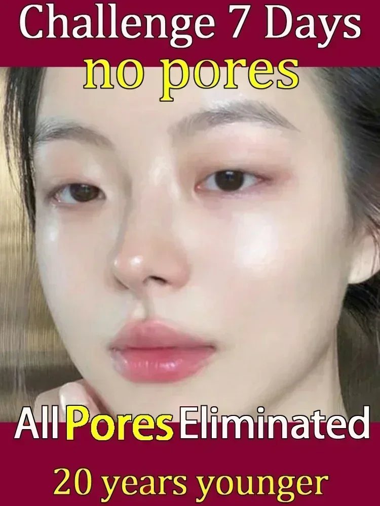 Лидер продаж сыворотка для сужения пор салициловая фруктовая кислота гель