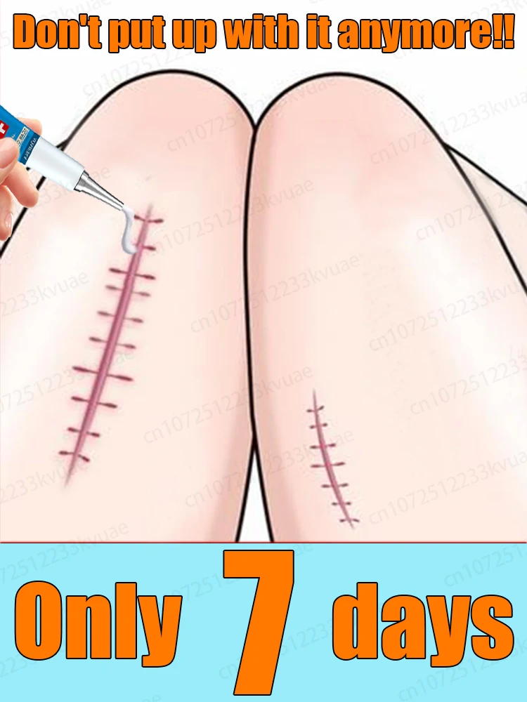 

S, sazi분Германия