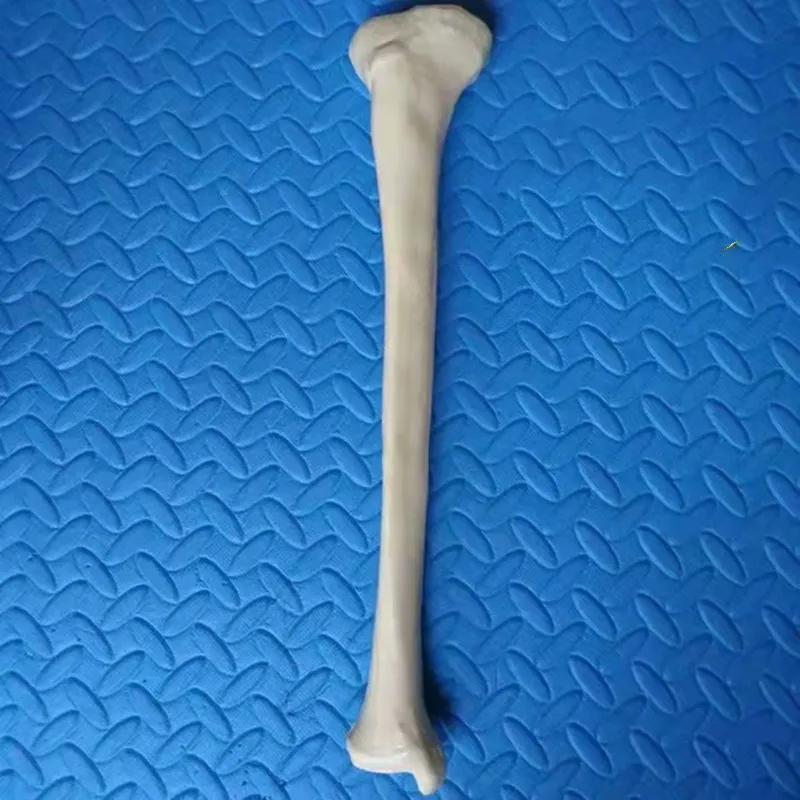 Humerus Femur голени бедра кости ключицы радиус Перона фибула человеческой