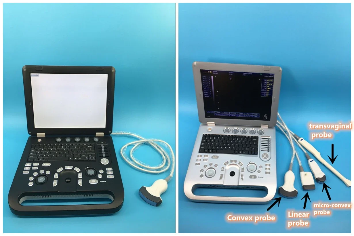 Профессиональный портативный 3D цветной дисплей черно-белый ультразвуковой