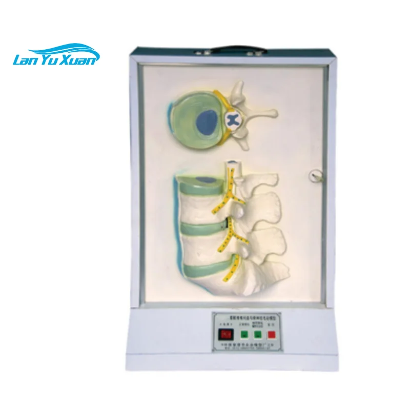 

BIX-A2127 Clear Display Lumbosacral Vertebra Intervertebral Disc and Spinal Nerve Electric Model