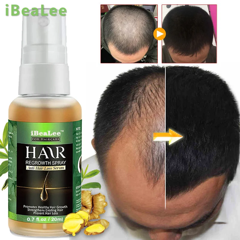 

Ginger Hair Growth Essential Oil Anti Hair Loss Treatment Spray Serum Care Dry Frizz Repair Damage Nourish Hair Root Essence