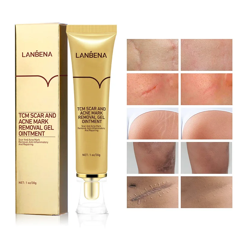 

LANBENA Skin Acne Scar Removal Cream Face Cream Repair Acne Spots Acne Treatment Blackhead Whitening Cream Stretch Marks 30ml