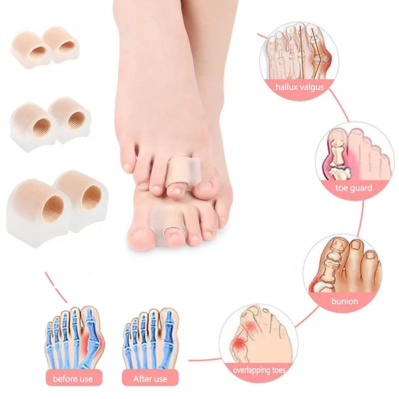 

Силиконовый разделитель для пальцев ног, разделитель для большого пальца ноги, при вальгусной деформации большого пальца, ортопедическая к...