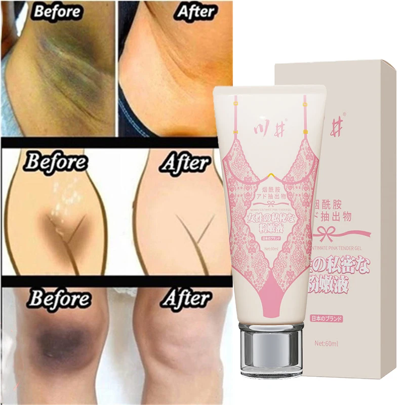 

60ml Intimate Area Body Whitening Cream Repair Improve Underarm Knee Buttock Private Body Dull Brighten Arbutin Skin Care