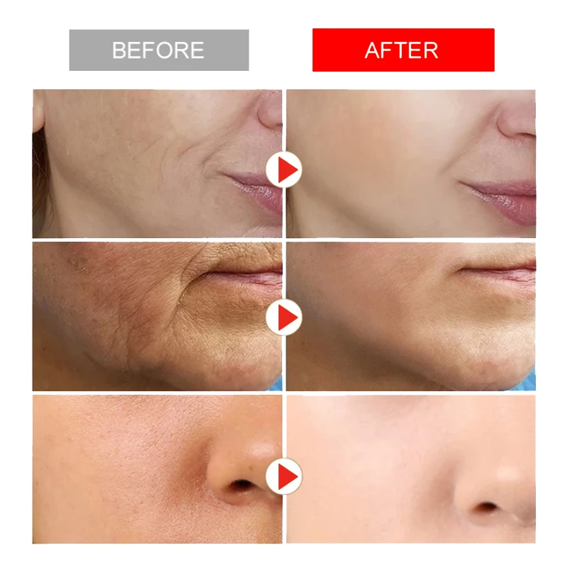 Полипептидный крем для удаления морщин лифтинг лица укрепляющий антивозрастной