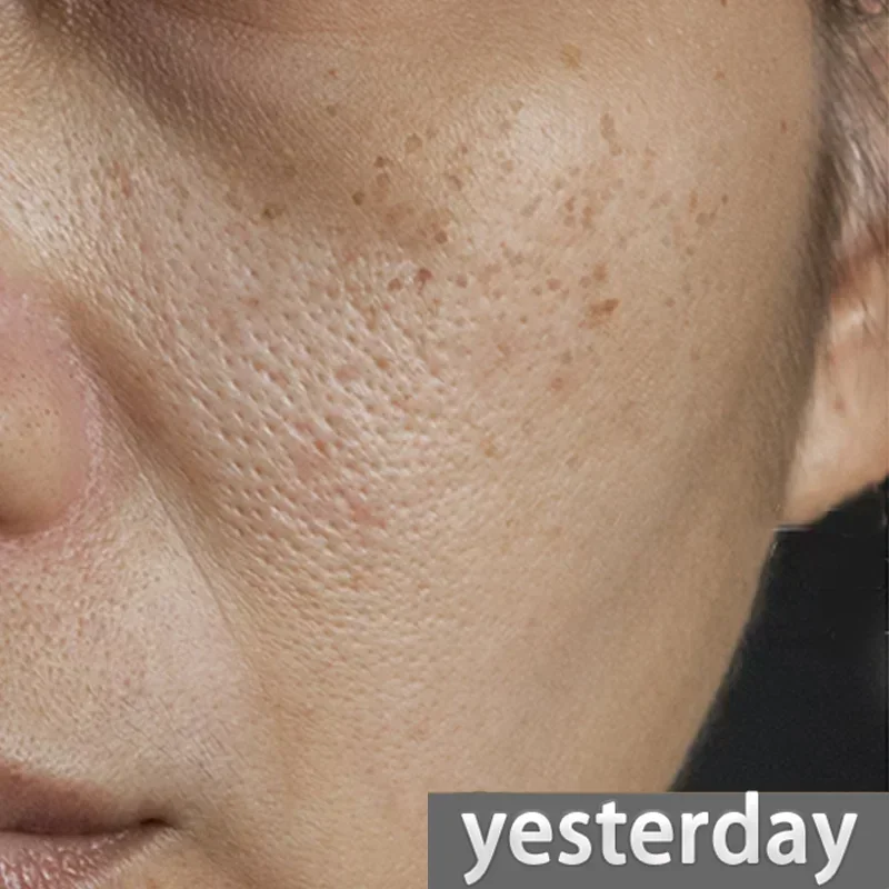 Эссенция для устранения всех пор лица укрепляющая восстанавливающая