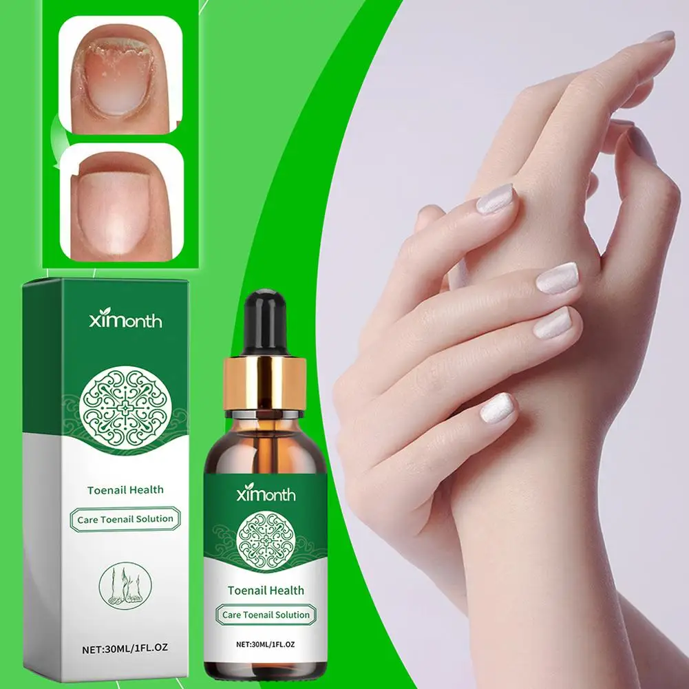 Ximonth Nail Fungal Treatment Essence Oil Foot Toe Health Removal Сыворотка от онихомикоза Beauty Fungus Infection Care Ant