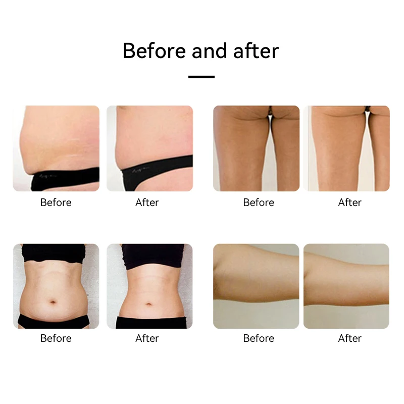 Ультразвуковой радиочастотный массажер для похудения потери веса живота рук