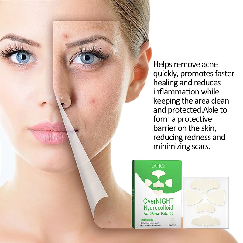 Невидимые пластыри от прыщей нос подбородка лоб щеки прыщи пятна следы консилер