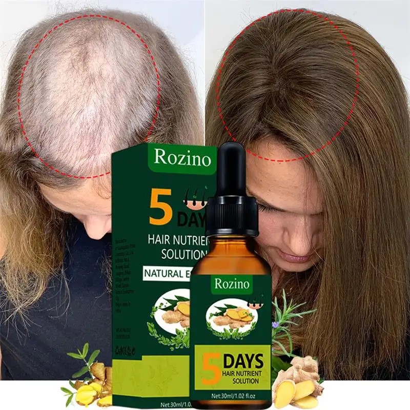

Hair Growth Essential Oils Fast Regrowth Prevent Hair Loss Serum Repair Damaged Root Scalp Treatment Thicken Hair Care Men Women