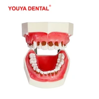 dental periodontal disease model typodont dental model teeth practice training studying teaching jaw models with removable tooth
