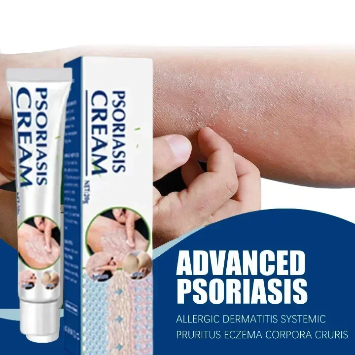 anie stubbinego psoriasis mchu specjalna maść lecznicza łuszczyca ciało i udo moss dermatosis swędzenie antybakteryjna egzema