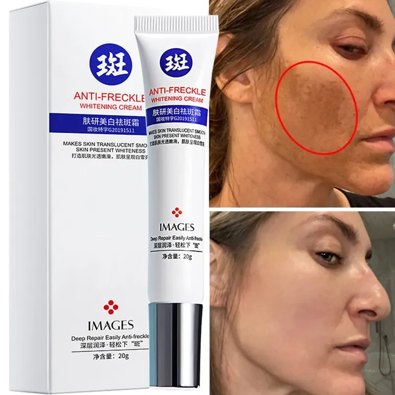 

Effective Whitening Freckle Cream Fade Melasma Dark Spots Pigment Melanin Dull Anti-Aging Moisturizing Brighten Smooth Skin Care