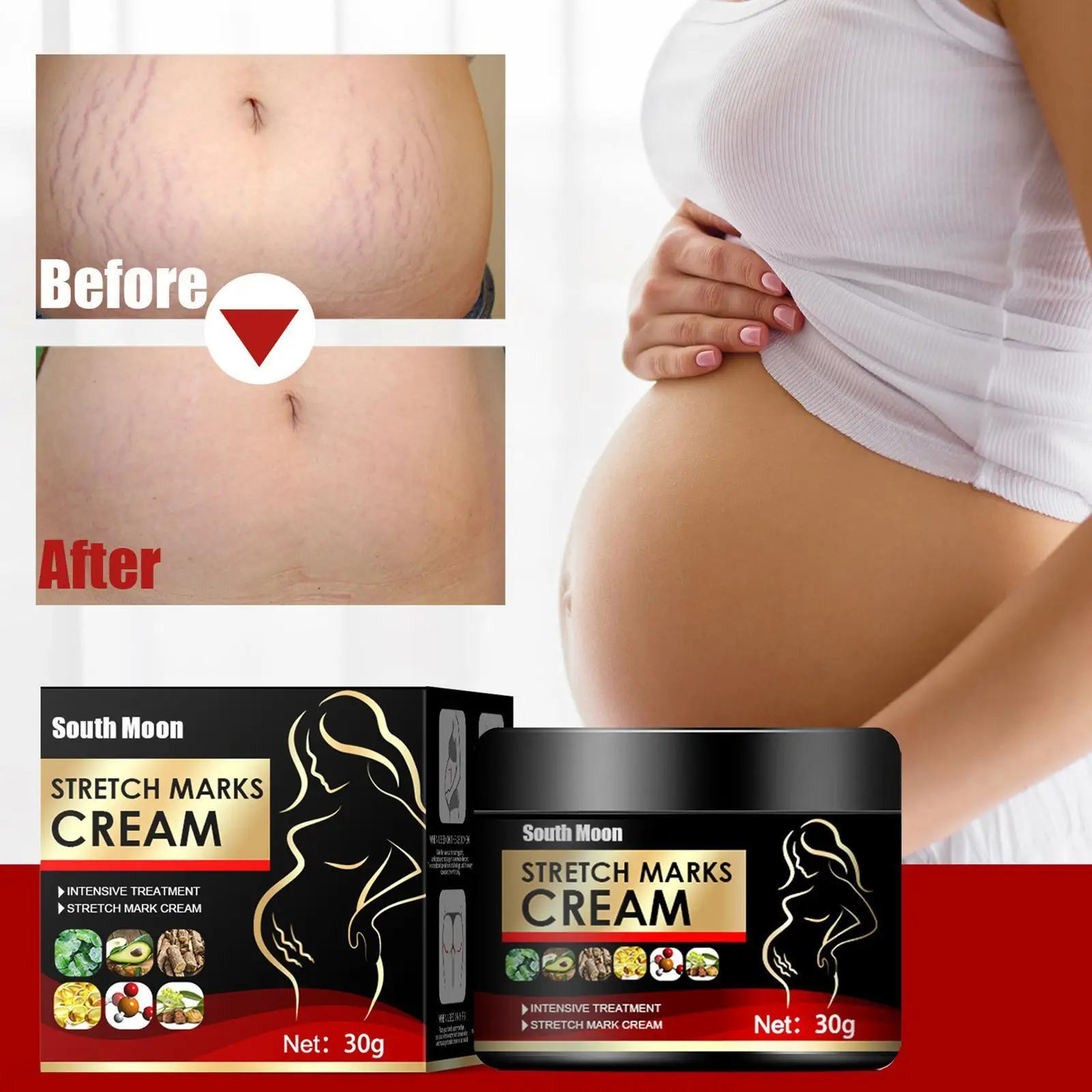 

Effective Remove Pregnancy Scars Acne Cream Pregnant Women Stretch Anti-Aging Repair Skin Body Anti-Winkle Firming Marks Ca N3F0