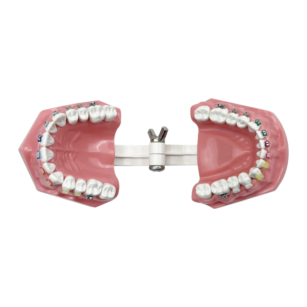 Полуметаллическая полукерамическая Стоматологическая Ортодонтическая модель