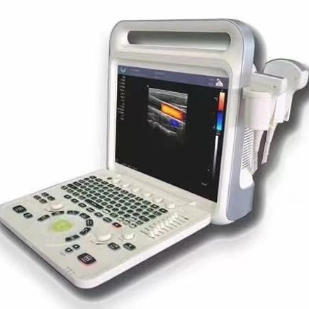 Конкурентная цена от производителя ультразвуковой сканер медицинское