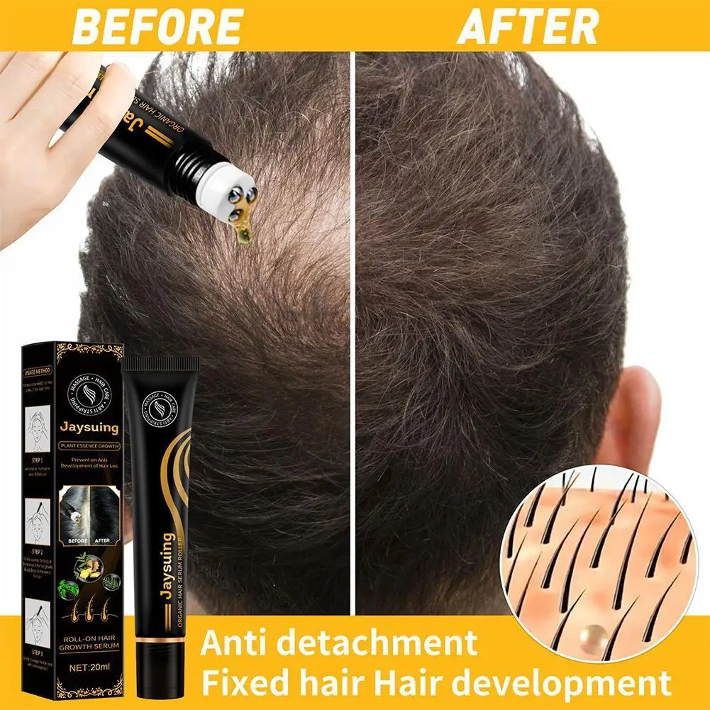 

20ml Organic Regrowth Hair Serum Roller Set Anti Stripping Liquid Hair Growth Care Suitable For All Types Of Hair Loss