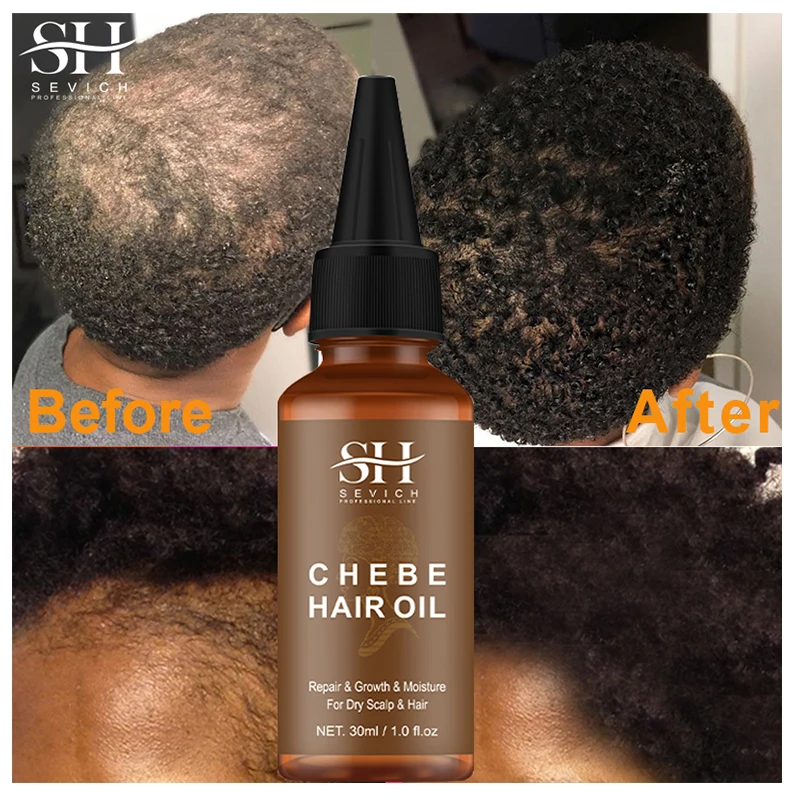 Fast Hair Growth Oil African Crazy Traction Alopecia Chebe Hair Mask Anti Hair Break Hair Strengthener Hair Loss Treatment Spray images - 6
