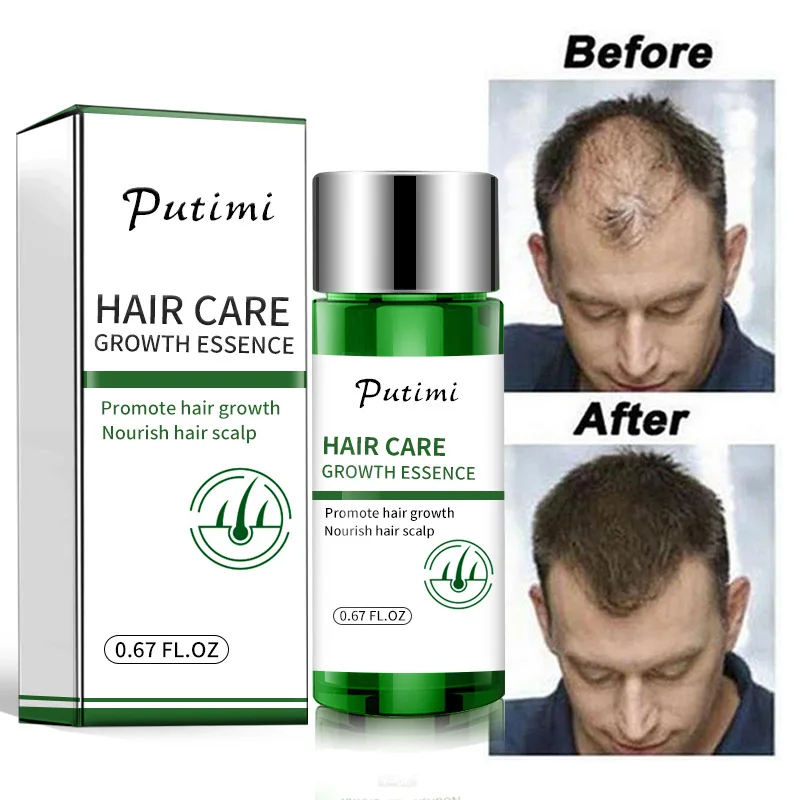 

Putimi Hair Growth Essential Oil Softening Conditioner Fast and Strong Hair Growth Products Prevent Hair Loss Nourishing Serum