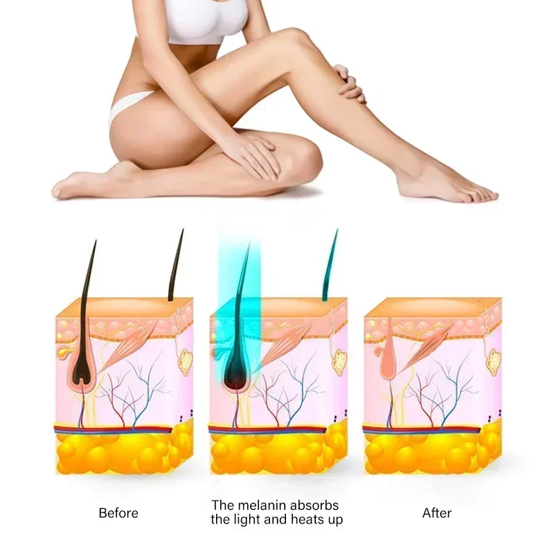 Notime Beste Kwaliteit Ipl Huidverjonging Apparaat Schoon Aduapparatuur On Brugingsapparaat Machine