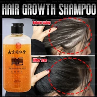 400ml ginger anti fall hair growth shampoo increases hair density and occurs hair liquid anti fall shampoo prevent hair breakage