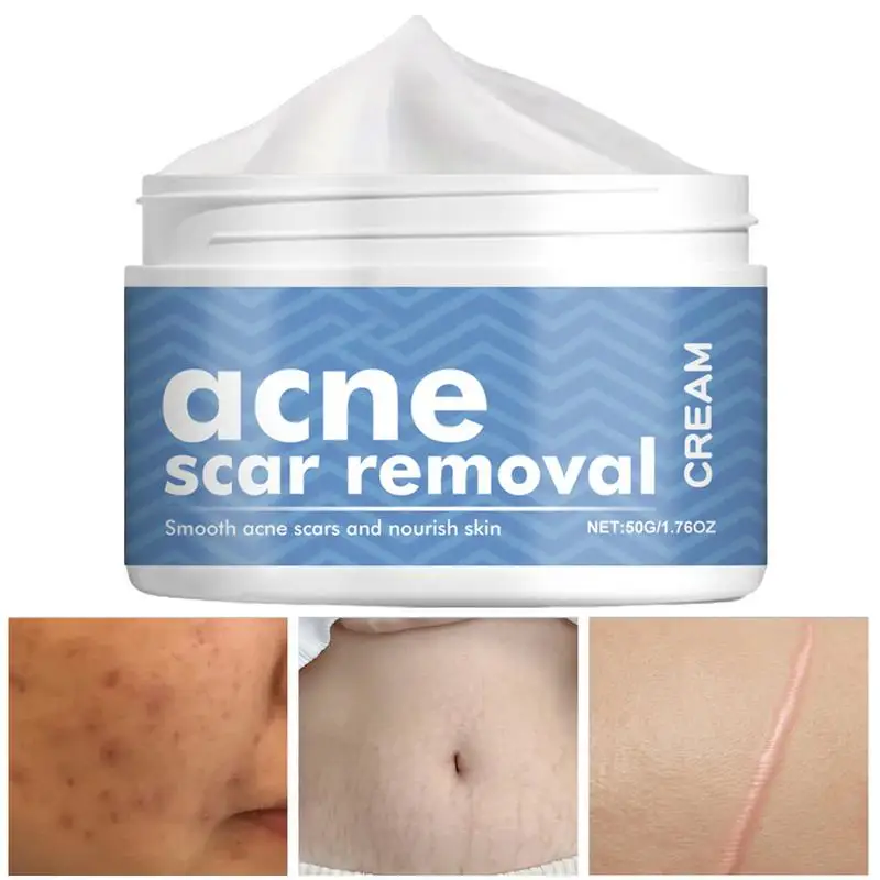 Крем для лица удаления прыщей гель против лечение шрамов от сужение пор