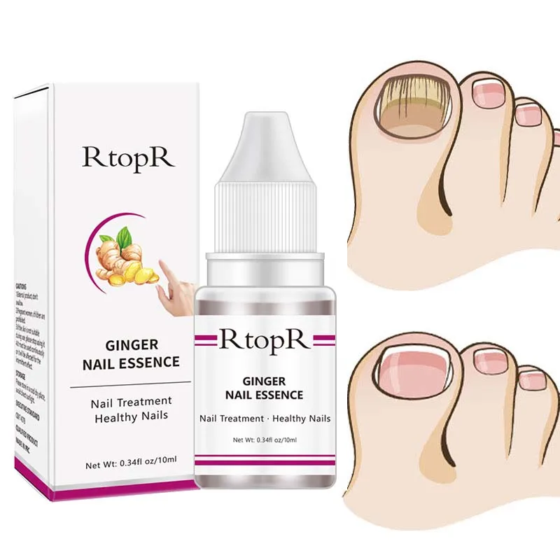 

1 шт., сыворотка для лечения ногтей от грибков