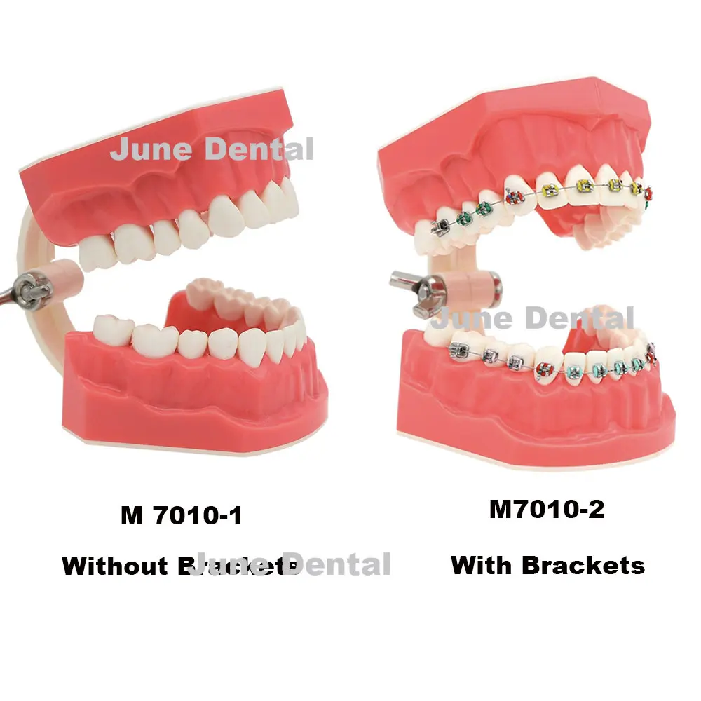 

Модель зубного типоноса, Ортодонтическая модель зубов 1:1 с кронштейнами, обучающий демонстрационный Тип 7010