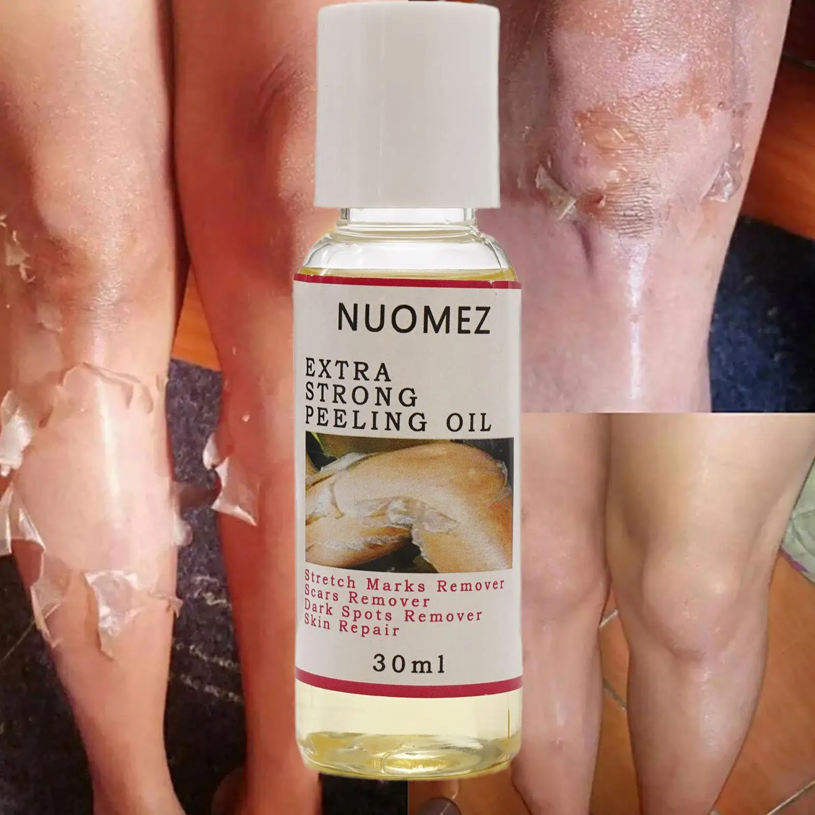 

Yellow Peeling Oil Dark Skin Bleach Lighten Arm Knee Legs Exfoliating Remove Dead Skin Improve Dull Skin Whitening Serum