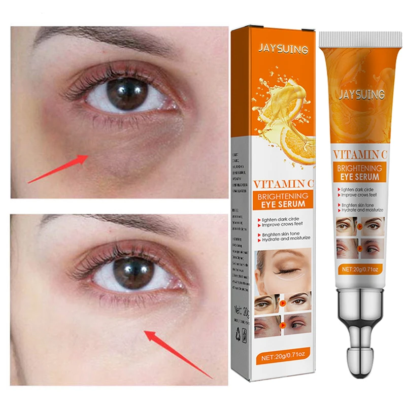 

Vitamin C Whitening Eyes Cream Lighten Dark Circles Under Eye Firming Crow's Feet Wrinkles Fine Lines Anti-Aging Remove Eye Bags