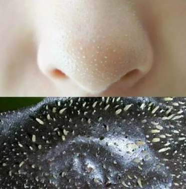 

Blackhead Remover Nose Sticker Acne Treatments Mask Nose Sticker 60pc From Black Dots Cleaner Nose Pore Deep Cleaning Skin Care